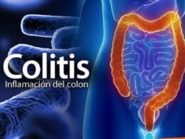 dieta y remedios caseros para la colitis publicado por smith rex