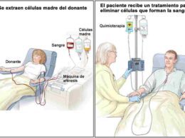 estudios de destacar el papel importante de los procedimientos trasplante de células madre para el tratamiento de cánceres de sangre