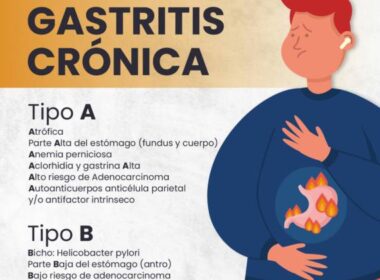 la gastritis crónica