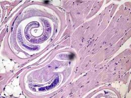 parásito de la triquinosis se descifra el adn