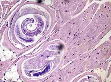 parásito de la triquinosis se descifra el adn