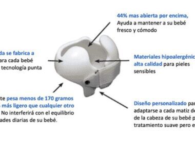 plagiocefalia en adultos